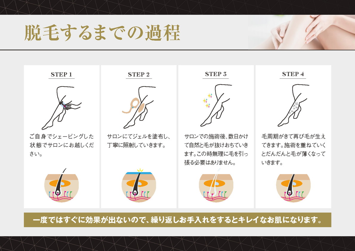 脱毛するまでの過程